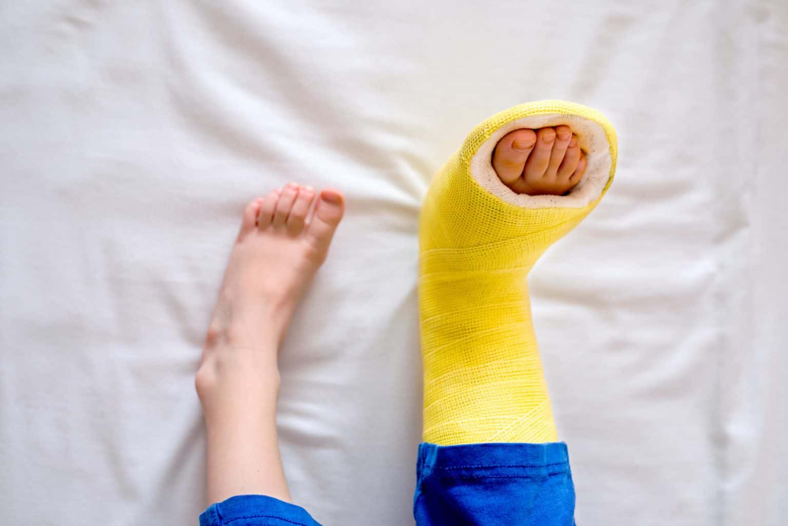 how-long-does-it-take-for-a-sprained-toe-to-heal-discover-causes