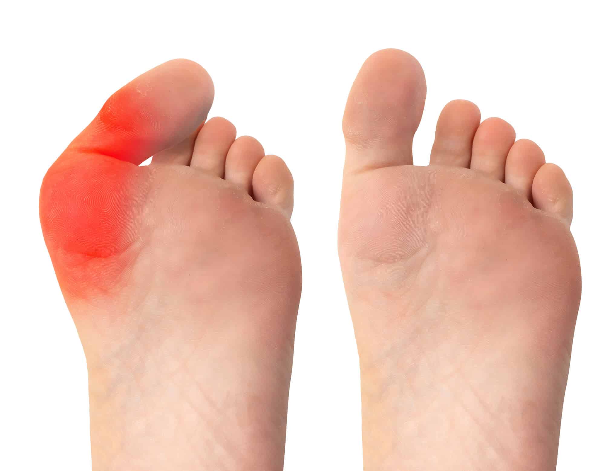 why-do-my-feet-hurt-when-i-run-10-basic-causes-and-how-to-prevent-them